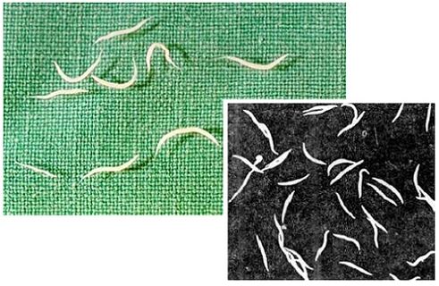 pinworms of human body