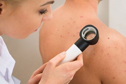 rash on the skin with parasites