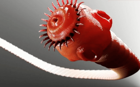 human body parasite worm