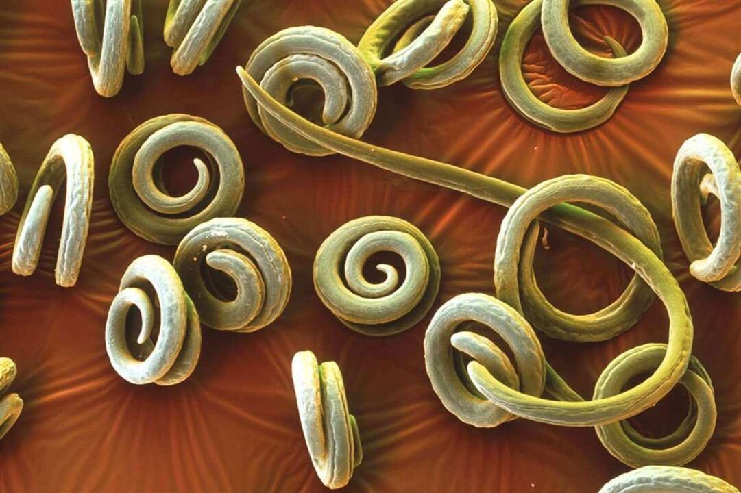 parasitic worms of the human body