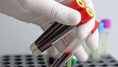 How to get out of tests for parasites in the body