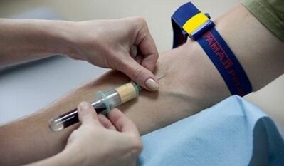 How to prepare for the parasites test