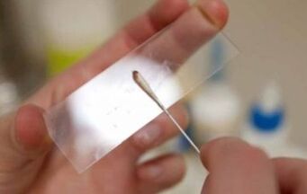 What tests should be carried out for parasites