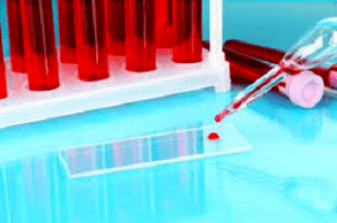 Blood test