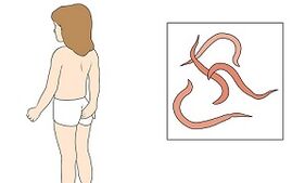 symptoms of the presence of parasites in the human body