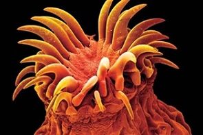 Trematode parasites in humans