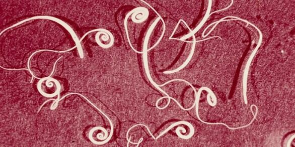 photo of human parasites